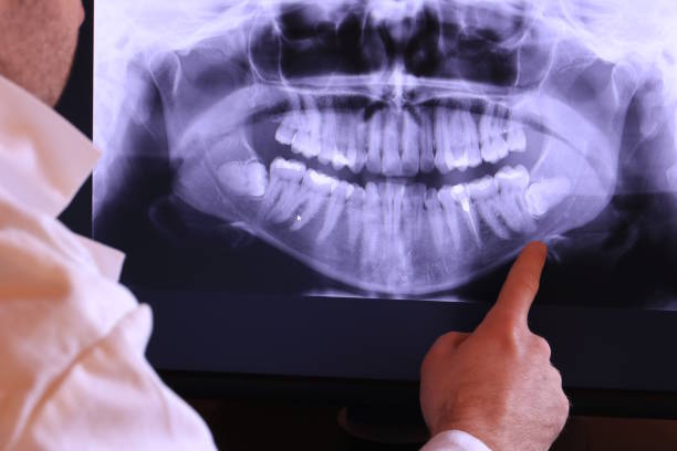 Best Emergency Dentist for Lost Fillings or Crowns in Willows, CA
